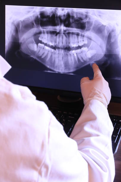 Best Emergency Broken Tooth Repair in Bemiss, GA