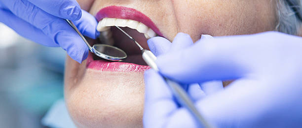 Best Emergency Broken Tooth Repair in Bemiss, GA