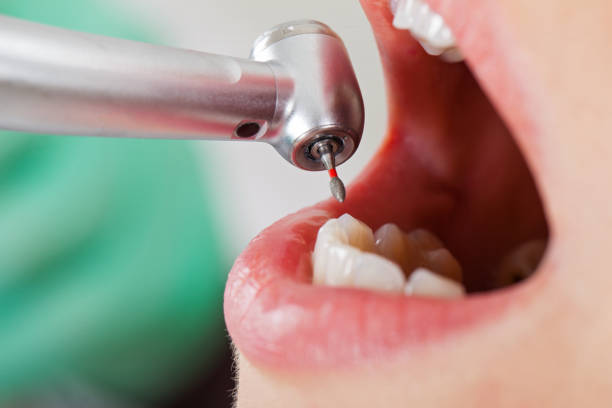 Best Walk-In Emergency Dentist in Bemiss, GA